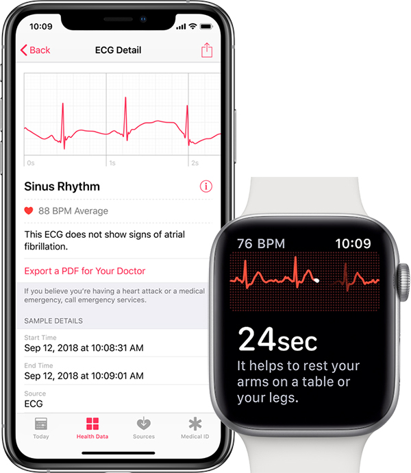 「ECG Apple watch」的圖片搜尋結果