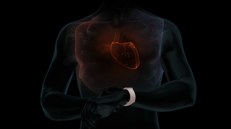 Apple Watch ECG