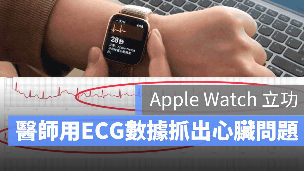 ECG 心電圖