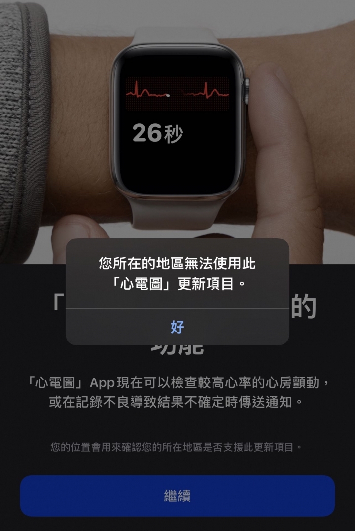ECG 心電圖