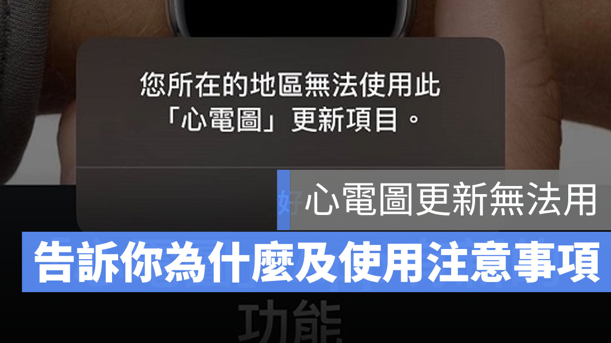 ECG 心電圖