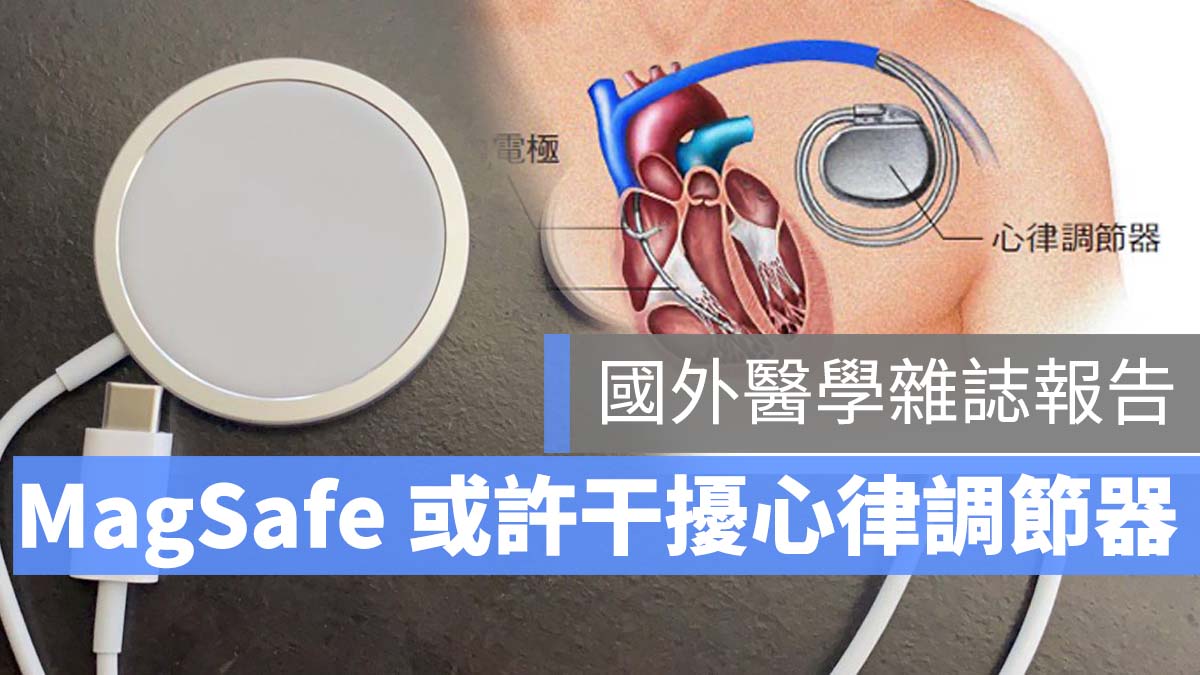 MagSafe 心律調節器 影響