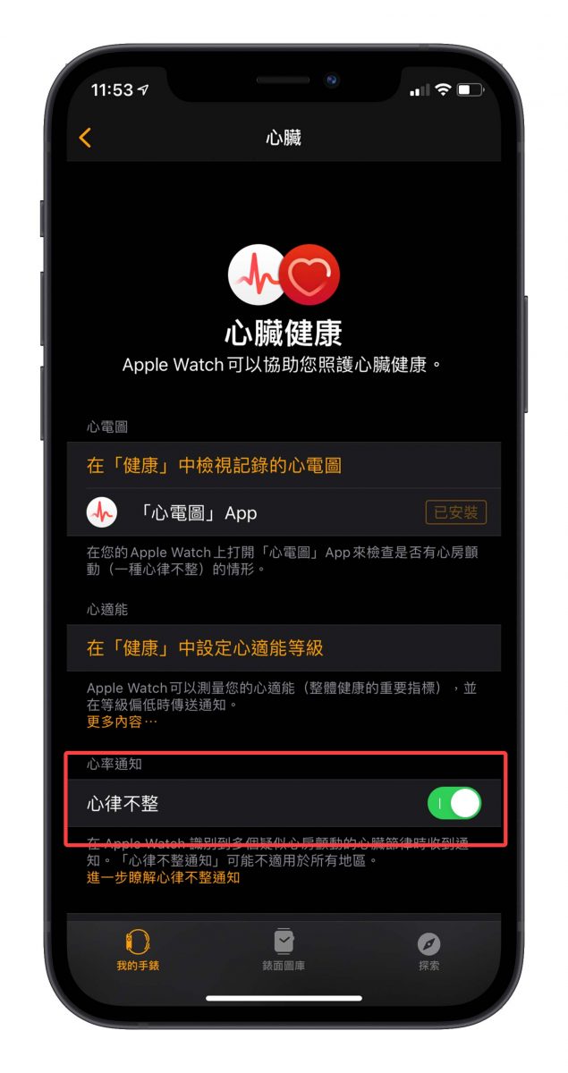ECG 心電圖 心律不整