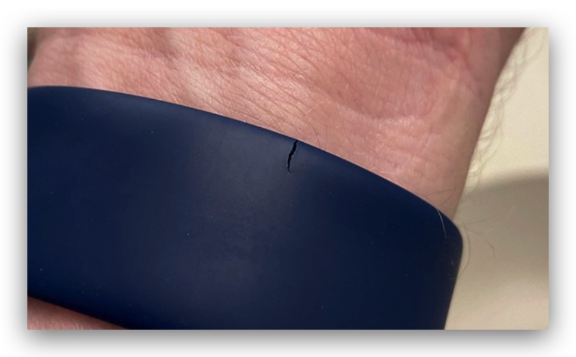 Apple Watch 錶帶斷裂