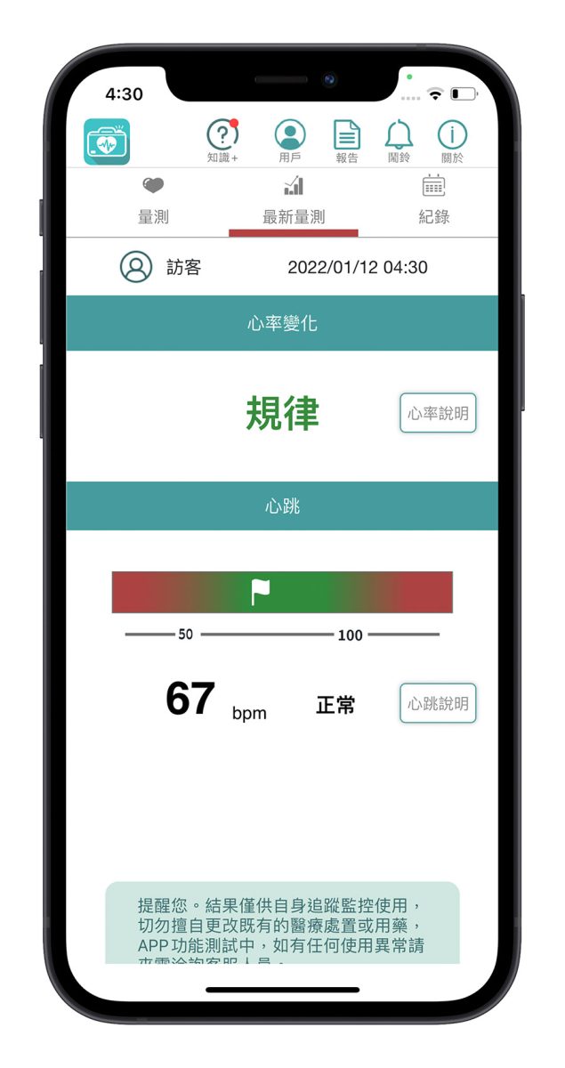 愛心鏡 iPhone 測心跳 心律不整