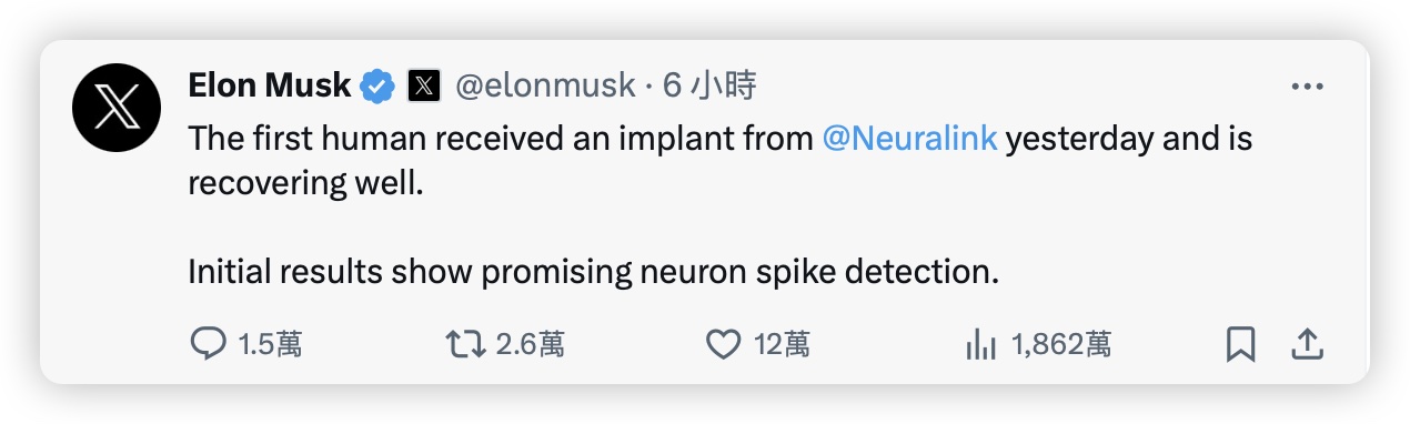 馬斯克 腦晶片 科技新知