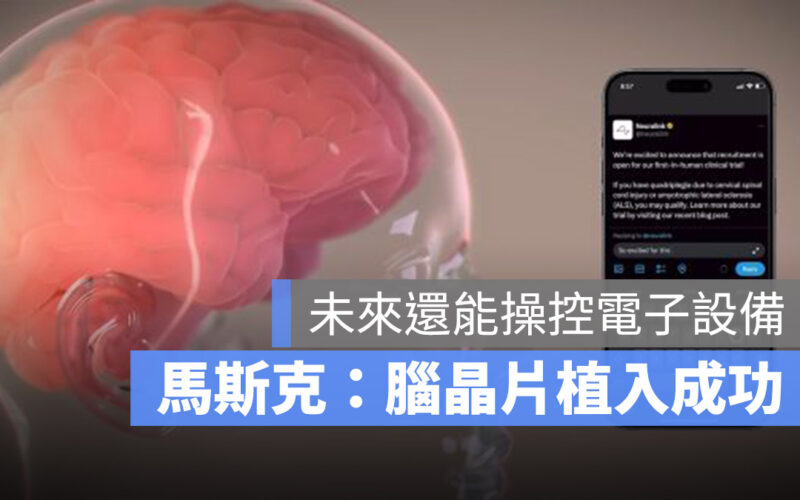 馬斯克:腦晶片 Neuralink 首次成功植入人體,患者目前恢復良好