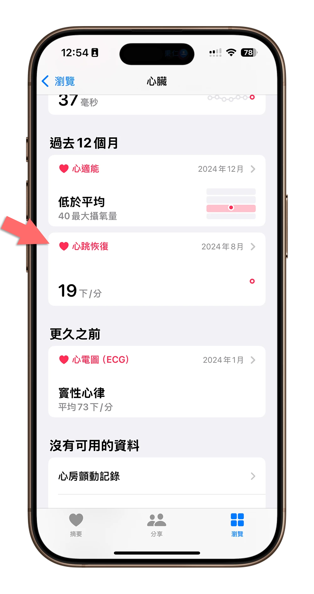 Apple Watch 心律不整通知 健康偵測